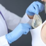 Complicații implant mamar explicate de Dr. Diana Gheorghiță