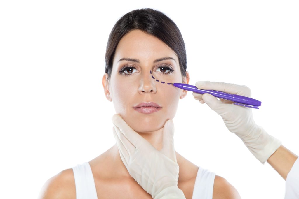 recuperare Blefaroplastie