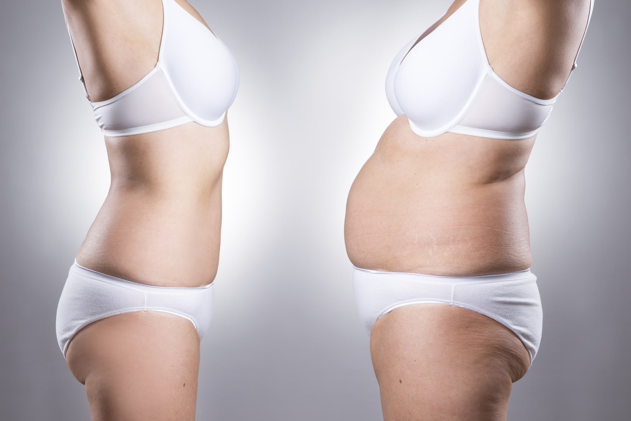 Înainte și după liposucție – transformare naturală