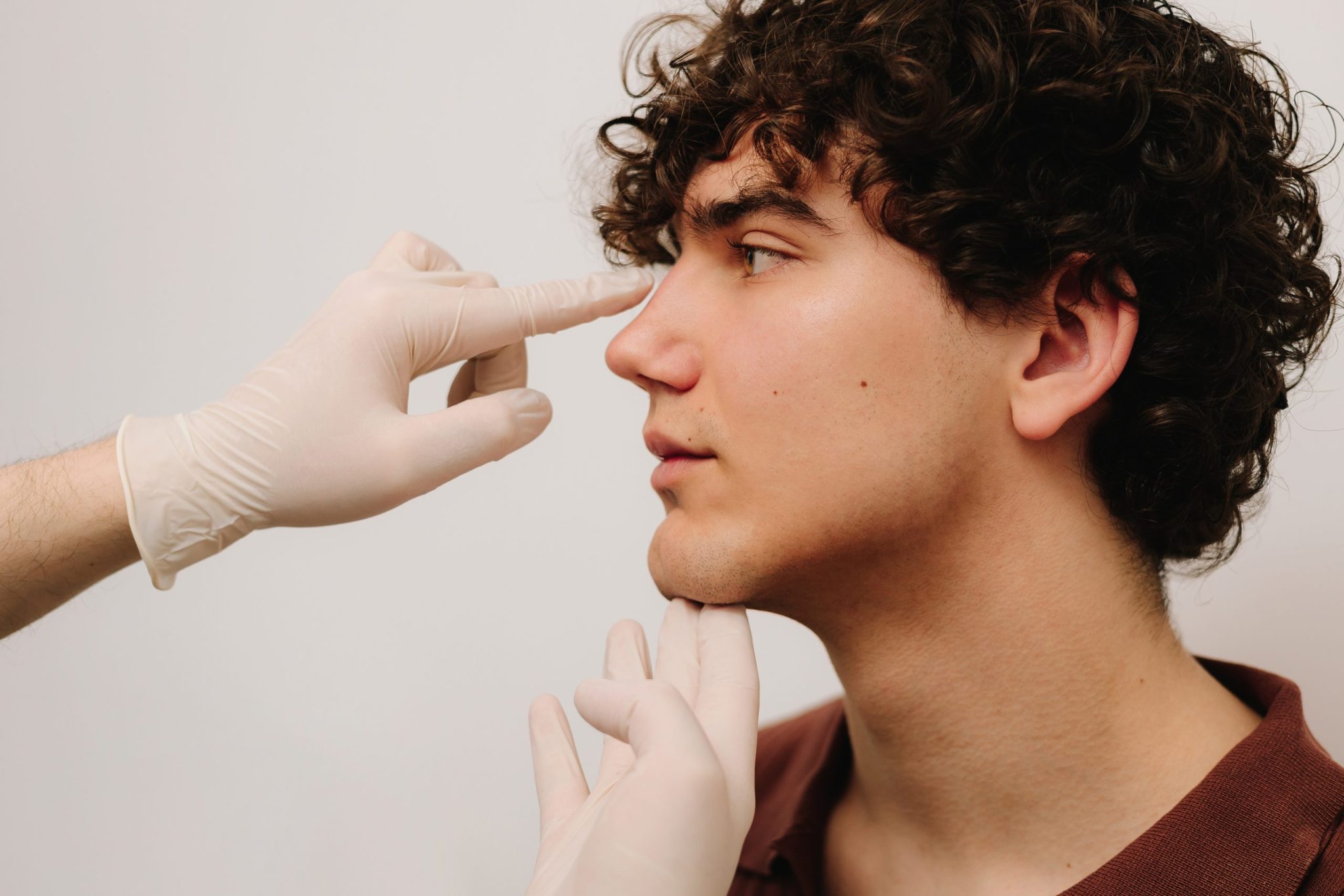Rinoplastie