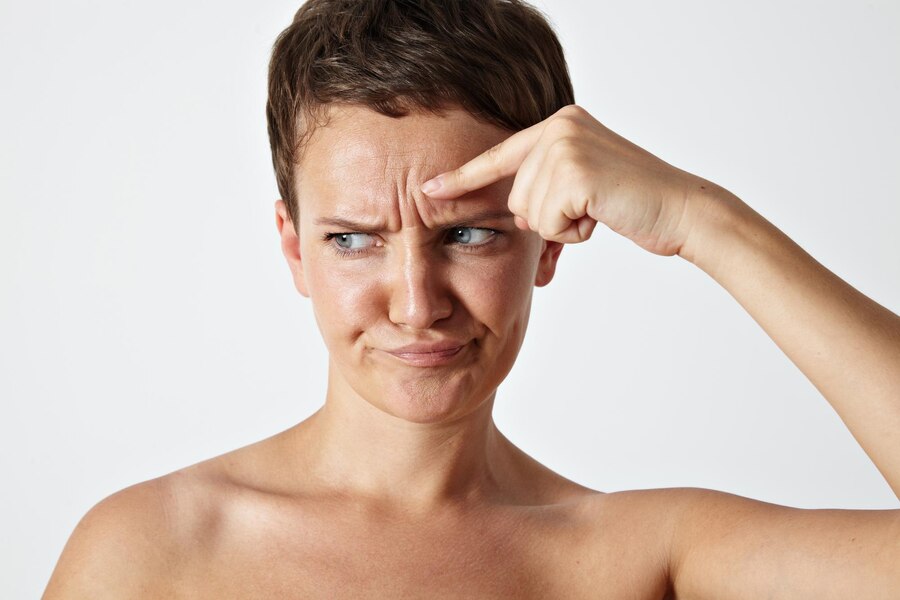 Tratament riduri cum scapi de riduri