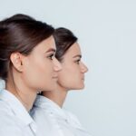 Rezultate înainte și după rinoplastia secundară realizată