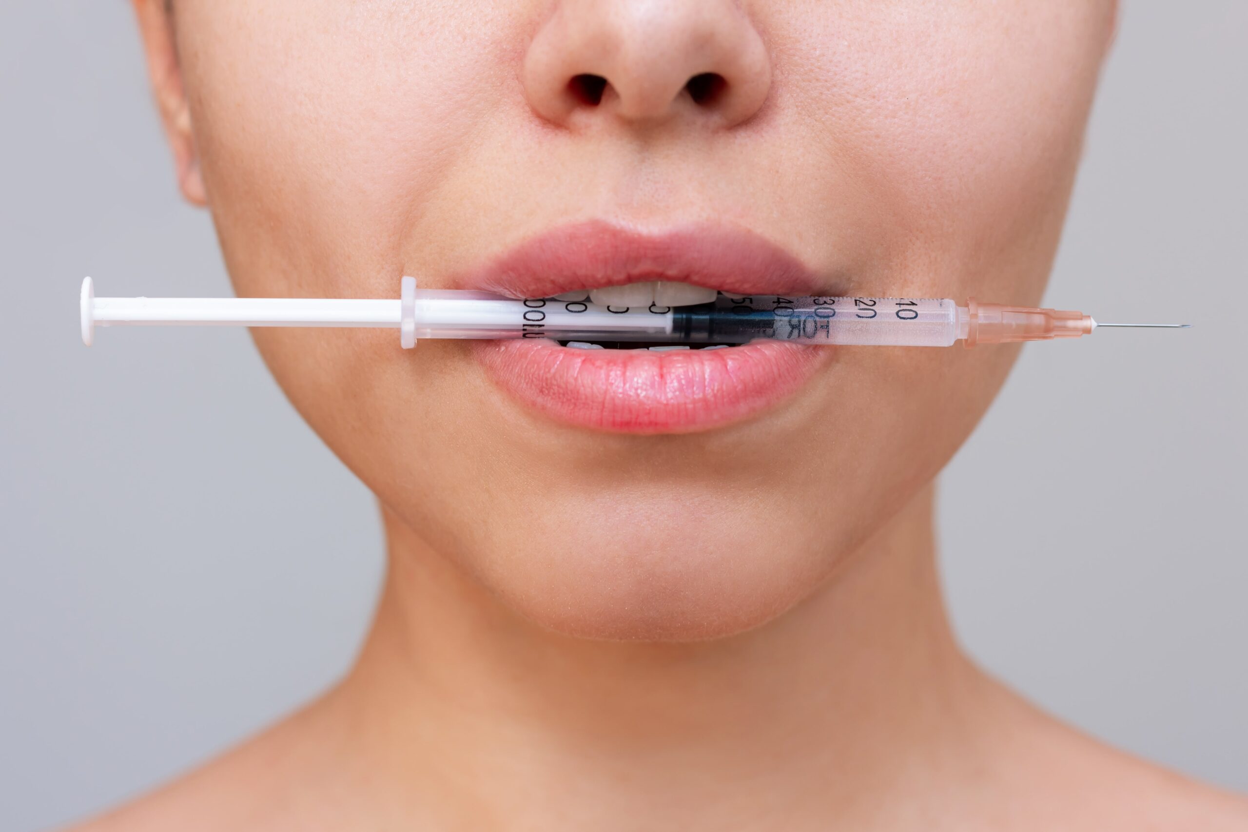 De ce apare migrarea acidului hialuronic?